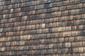 Shingles